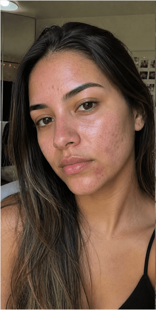 Antes — Larissa Mendonça